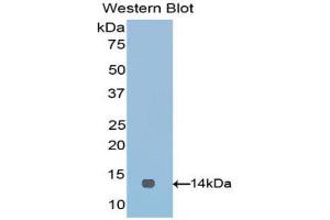 Western blot analysis of the recombinant protein. (VTCN1 antibody  (AA 34-147))