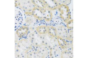 Immunohistochemistry of paraffin-embedded rat kidney using SLC39A7 antibody (ABIN5971725) at dilution of 1/100 (40x lens). (SLC39A7 antibody)