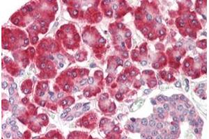 Human Pancreas: Formalin-Fixed, Paraffin-Embedded (FFPE) (SGSM1 antibody  (Internal Region))