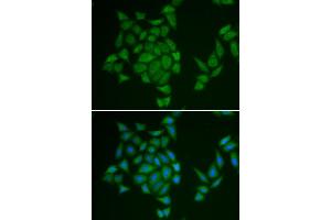 Immunofluorescence analysis of HeLa cell using AMPD3 antibody. (AMPD3 antibody)