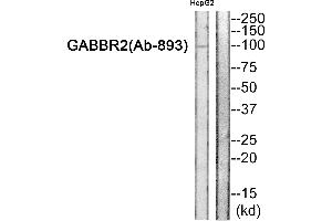 Western blot analysis of extracts from HepG2 cells, using GABBR2 (Ab-893) Antibody. (GABBR2 antibody  (Internal Region))