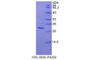 SDS-PAGE (SDS) image for Pannexin 1 (PANX1) (AA 77-260) protein (His tag) (ABIN2121808) (PANX1 Protein (AA 77-260) (His tag))