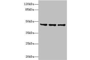 Western blot All lanes: FAM53B antibody at 2 μg/mL Lane 1: MCF-7 whole cell lysate Lane 2: A549 whole cell lysate Lane 3: HCT116 whole cell lysate Secondary Goat polyclonal to rabbit IgG at 1/10000 dilution Predicted band size: 46, 34 kDa Observed band size: 46 kDa (FAM53B antibody  (AA 1-305))