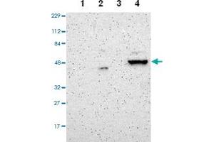 Western blot analysis of Lane 1: Human cell line RT-4, Lane 2: Human cell line U-251MG sp, Lane 3: Human plasma (IgG/HSA depleted), Lane 4: Human liver tissue with ZNF670 polyclonal antibody  at 1:100-1:250 dilution.