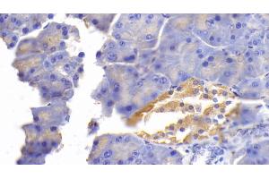 Immunohistochemistry (IHC) image for anti-Fibronectin (AA 2117-2236) antibody (ABIN7428998)