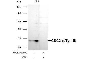 Western blot analysis of extracts from 293 cells, treated with Hydroxyurea or calf intestinal phosphatase (CIP), using CDC2 (Phospho-Tyr15) Antibody. (CDK1 antibody  (pTyr15))