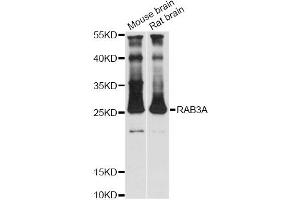 Western blot analysis of extracts of various cell lines, using RAB3A antibody (ABIN1876567) at 1:3000 dilution. (RAB3A antibody)