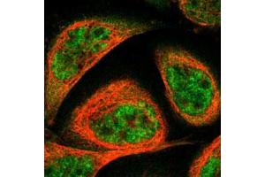 Immunofluorescent staining of human cell line A-431 with TERF2 polyclonal antibody  under 1-4 ug/mL working concentration shows positivity in cytoplasm & nucleus but excluded from the nucleoli.
