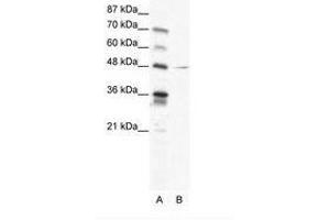 Image no. 1 for anti-Nuclear Factor I/C (CCAAT-Binding Transcription Factor) (NFIC) (AA 184-233) antibody (ABIN202501) (NFIC antibody  (AA 184-233))