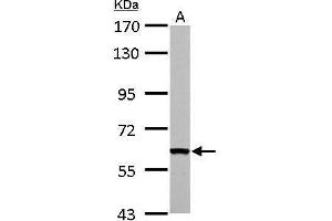 WB Image FAST antibody detects FASTK protein by Western blot analysis. (FASTK antibody  (C-Term))