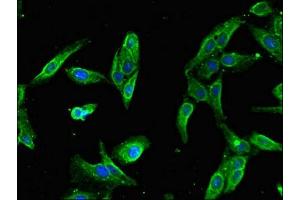 Immunofluorescent analysis of Hela cells using ABIN7168622 at dilution of 1:100 and Alexa Fluor 488-congugated AffiniPure Goat Anti-Rabbit IgG(H+L) (SLFN11 antibody  (AA 670-821))