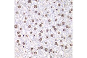 Immunohistochemistry of paraffin-embedded mouse liver using TOP1 antibody at dilution of 1:100 (400x lens).