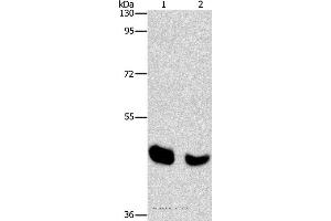 Western blot analysis of Human normal liver and mouse pancreas tissue, using BAAT Polyclonal Antibody at dilution of 1:650 (BAAT antibody)