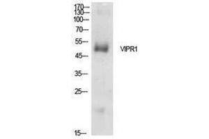 Western Blotting (WB) image for anti-Vasoactive Intestinal Peptide Receptor 1 (VIPR1) (Internal Region) antibody (ABIN3181427) (VIPR1 antibody  (Internal Region))