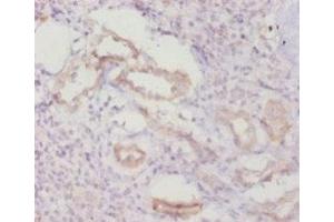 Immunohistochemistry of paraffin-embedded human kidney tissue using ABIN7146964 at dilution of 1:20 (Caspase 8 antibody  (AA 217-374))