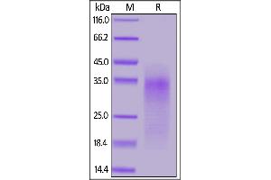 SDS-PAGE (SDS) image for CD24 Molecule (CD24) (AA 27-53) protein (His tag) (ABIN7013386)