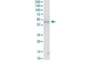 MICA MaxPab rabbit polyclonal antibody. (MICA antibody  (AA 1-383))
