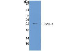 Detection of Recombinant FTL, Bovine using Polyclonal Antibody to Ferritin, Light Polypeptide (FTL) (FTL antibody  (AA 1-175))