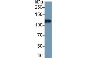 Western Blotting (WB) image for anti-Inter alpha Globulin Inhibitor H4 (ITIH4) (AA 683-928) antibody (ABIN7438337)
