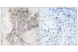 Immunohistochemistry (IHC) image for anti-beta 1,3-Galactosyltransferase-Like (B3GALTL) (C-Term) antibody (ABIN1850900) (B3GALTL antibody  (C-Term))