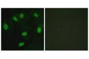 Immunofluorescence analysis of HeLa cells, using TBX15/18 antibody. (T-Box 15 antibody)