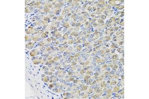 Immunohistochemistry of paraffin-embedded mouse stomach using CBR3 antibody (ABIN5975603) at dilution of 1/100 (40x lens). (CBR3 antibody)