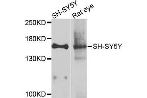 Western blot analysis of extracts of various cells, using ADCY2 antibody. (ADCY2 antibody)