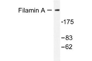 Image no. 1 for anti-Filamin A, alpha (FLNA) antibody (ABIN265421) (Filamin A antibody)