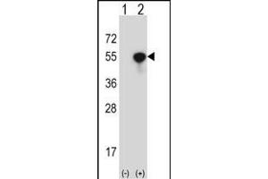 Western blot analysis of NCK1 (arrow) using rabbit polyclonal NCK1 Antibody (N-term) (ABIN657648 and ABIN2846643). (NCK1 antibody  (N-Term))