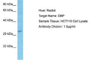 Host: Rabbit Target Name: DBP Sample Type: HCT116 Whole Cell lysates Antibody Dilution: 1.