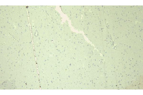 SCN5A antibody  (Internal Region)