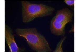 Image no. 3 for anti-Protein Kinase C, theta (PRKCQ) (pSer676) antibody (ABIN197070) (PKC theta antibody  (pSer676))