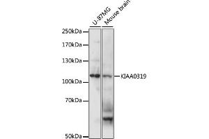 Western blot analysis of extracts of various cell lines, using KI antibody (ABIN7268112) at 1:1000 dilution. (KIAA0319 antibody  (AA 21-300))