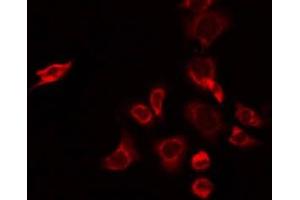 ABIN6274954 staining A549 by IF/ICC. (CHST2 antibody  (N-Term))