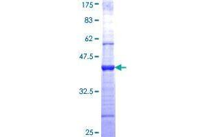 WIF1 Protein (AA 29-138) (GST tag)