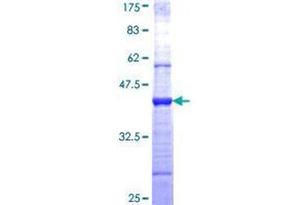WIF1 Protein (AA 29-138) (GST tag)