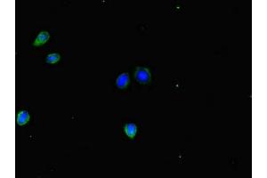 Immunofluorescent analysis of HepG2 cells using ABIN7155679 at dilution of 1:100 and Alexa Fluor 488-congugated AffiniPure Goat Anti-Rabbit IgG(H+L) (DLX5 antibody  (AA 1-249))