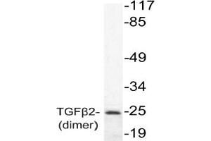 Image no. 1 for anti-Transforming Growth Factor, beta 2 (TGFB2) antibody (ABIN271850) (TGFB2 antibody)