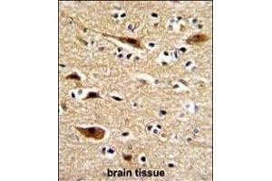 Formalin-fixed and paraffin-embedded human brain with P Antibody (N-term), which was peroxidase-conjugated to the secondary antibody, followed by DAB staining. (APP antibody  (N-Term))