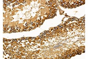 ABIN6260554 and ABIN6272679 at 1/100 staining Rat testis tissue by IHC-P.