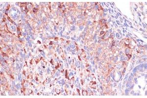 Immunohistochemistry of paraffin-embedded Rat ovary using WNT10B Polyclonal Antibody at dilution of 1:100 (40x lens).