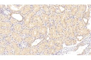 Detection of F2 in Human Kidney Tissue using Monoclonal Antibody to Coagulation Factor II (F2) (Prothrombin antibody)