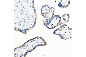 Immunohistochemistry of paraffin-embedded human placenta using LNPEP Rabbit pAb (ABIN6129286, ABIN6143284, ABIN6143285 and ABIN6215523) at dilution of 1:100 (40x lens).
