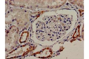 Immunocytochemistry analysis of human kidney tissue using ABIN7171654 at dilution of 1:100 (TBC1D4 antibody  (AA 1-94))