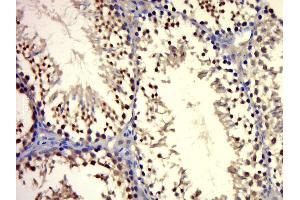 Paraformaldehyde-fixed, paraffin embedded mouse testis, Antigen retrieval by boiling in sodium citrate buffer (pH6. (Androgen Receptor antibody  (AA 825-919))