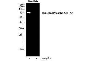 Western Blotting (WB) image for anti-Forkhead Box O1 (FOXO1) (pSer329) antibody (ABIN3182538) (FOXO1 antibody  (pSer329))
