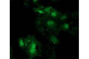 Immunofluorescence (IF) image for anti-Eukaryotic Translation Initiation Factor 4E Family Member 2 (EIF4E2) antibody (ABIN1497992) (EIF4E2 antibody)