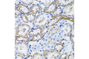 Immunohistochemistry of paraffin-embedded mouse kidney using PEX5 antibody (ABIN5973402) at dilution of 1/100 (40x lens).