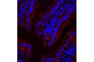 Immunofluorescence (Paraffin-embedded Sections) (IF (p)) image for anti-Linker For Activation of T Cells Family, Member 2 (LAT2) antibody (ABIN7074503)