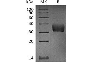 Western Blotting (WB) image for Sialic Acid Binding Ig-Like Lectin 15 (SIGLEC15) (Active) protein (His tag) (ABIN7321020) (SIGLEC15 Protein (His tag))